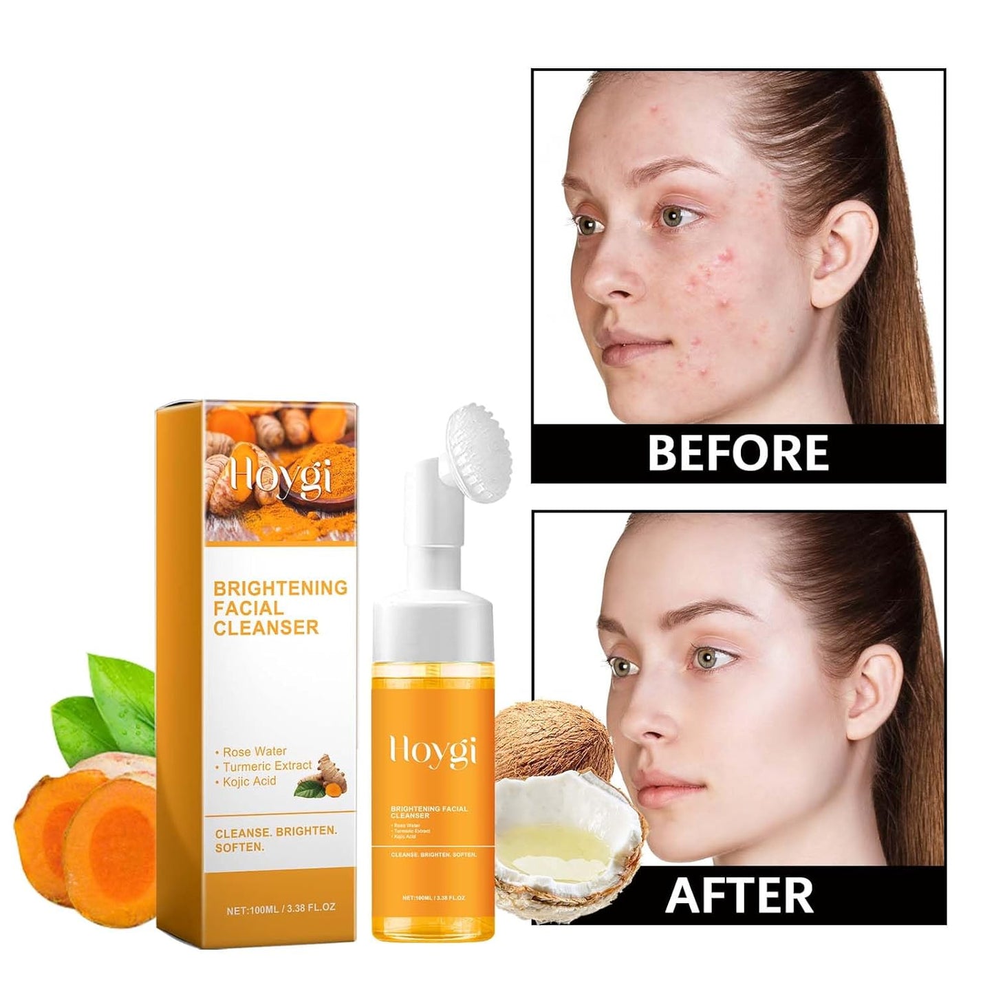 Revitalize Your Skin with Our Nourishing Turmeric Foaming Facial Cleanser – Perfect for All Skin Types!